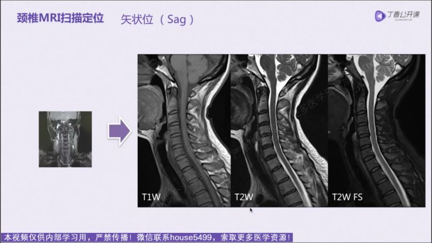 丁香园：脊柱MRI进阶指南【共11节】【全】【248元】，网盘下载(8.65G)